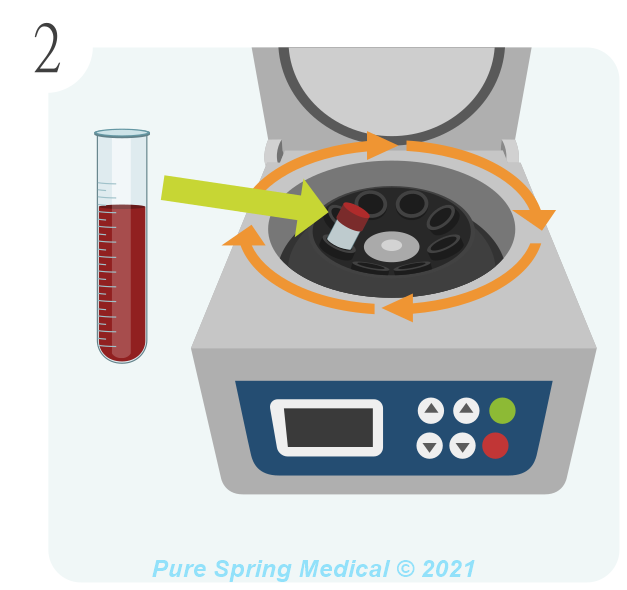 PRP preparation - Step 2