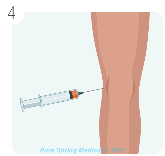 PRP preparation - Step 4